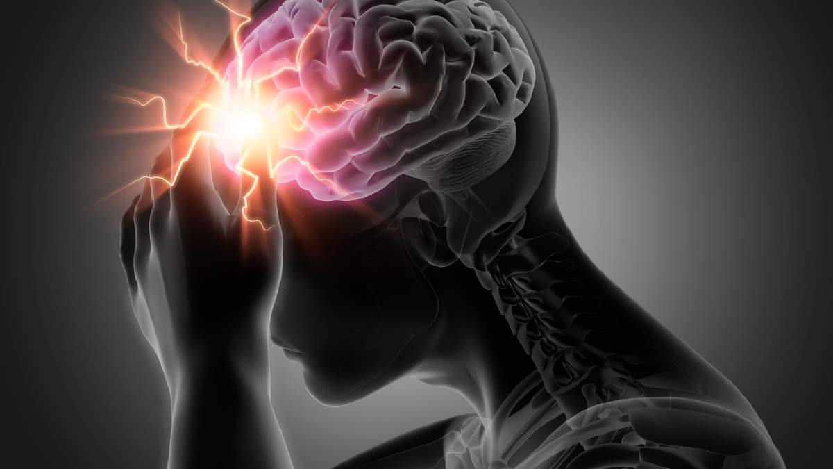 visual illustration of the brain with a stroke