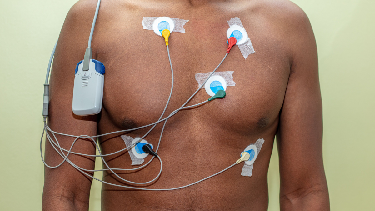 24-hour Holter monitoring device